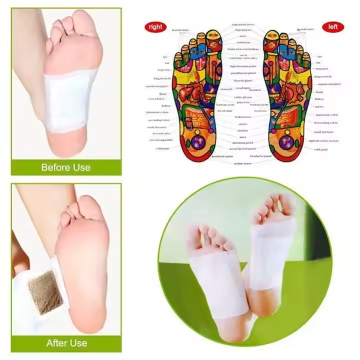Parches Kinoki – Pack de 10 Almohadillas Detox para Pies